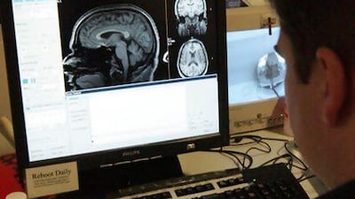 Covid-19 may be able to hide in the brain, with one possible route in being through the nose. AP