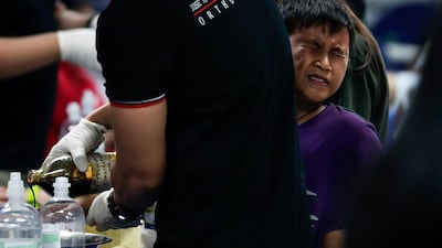 A boy injured from a fireworks accident is being treated at a hospital during New Year's Eve celebrations in Manila, Philippines, January 1, 2018. Mark R Cristino / EPA