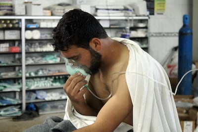 A victim of a chlorine attack in Syria in 2015. Getty Images