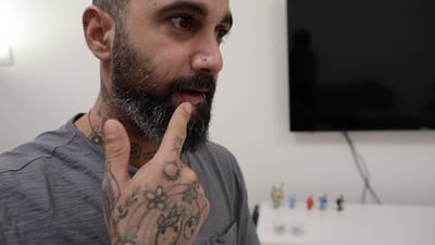 Jean-Georges Prince at his apartment in Dubai showing the bullet scar on his lips. Suhail Rather / The National