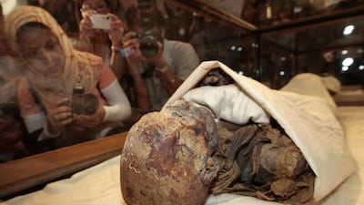 The remains of Ancient Egyptian ruler Queen Hatshepsut. Exposure to fungal spores in mummified remains has been linked to illnesses and deaths. Photo: AFP