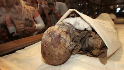 The remains of Ancient Egyptian ruler Queen Hatshepsut. Exposure to fungal spores in mummified remains has been linked to illnesses and deaths. Photo: AFP