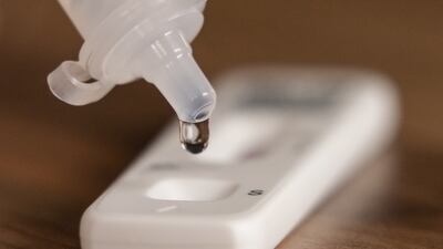 A man has finally produced a negative Covid-19 test after 411 days. PA