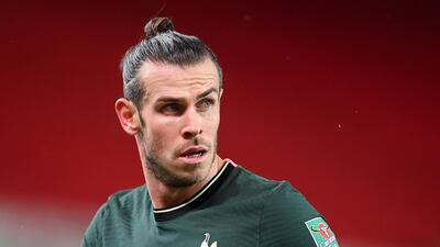 Gareth Bale is out for a few weeks at least. Getty