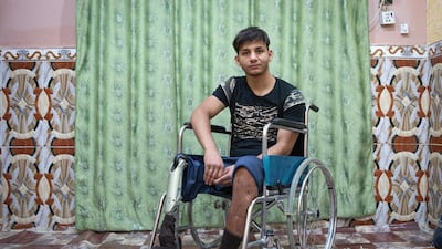 Jasim Abdulameer, 22, once a PMU fighter was injured during a military operation against ISIS. Amputee and jobless, he lives with his parents in Basra, a major city in south Iraq. Photo by Sebastian Castelier
