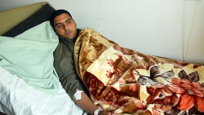 Mohamed Abdel Fattah, the imam of Al Rawdah mosque recovering in Al Husseiniya hospital in Sharqiya on November 26, 2017 , the day after surviving the attack by militants on the mosque. Mohamed El-Shahed / AFP