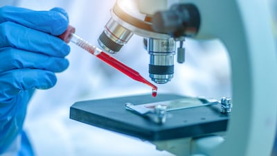 Experts say the blood test may be widely available in three to five years, if further research is successful. Getty Images