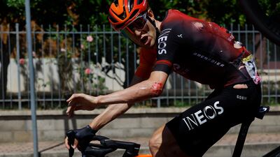 Ineos Grenadiers' Laurens de Plus with cuts and grazes after a crash during Stage 2. Reuters