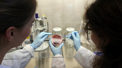 German researches study a streptococcus bacterial colony. The bacterium can cause skin, soft tissue and respiratory tract infections, which are treated with antibiotics. AP