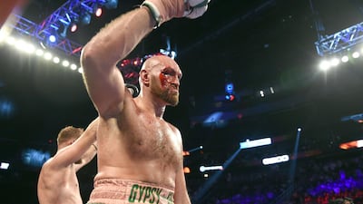Tyson Fury reacts after the final bell in his heavy weight fight against Otto Wallin at T-Mobile Arena. AFP