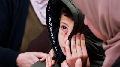 Mustafa Bani Odeh, eight, survived an attack by Israeli soldiers that killed his parents and two siblings in the occupied West Bank. AFP