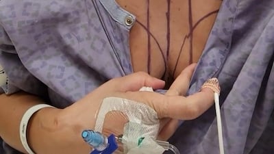 Sarah shared this image ahead of a double mastectomy in November 23, 2021.