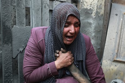 A wounded Palestinian woman holds the hand of her dead relative outside her home following Israeli airstrikes that targeted their neighbourhood in Gaza City, on October 23. AP