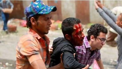 Egyptian anti-Scaf protesters help a wounded demonstrator during clashes in the Abbassiya district.