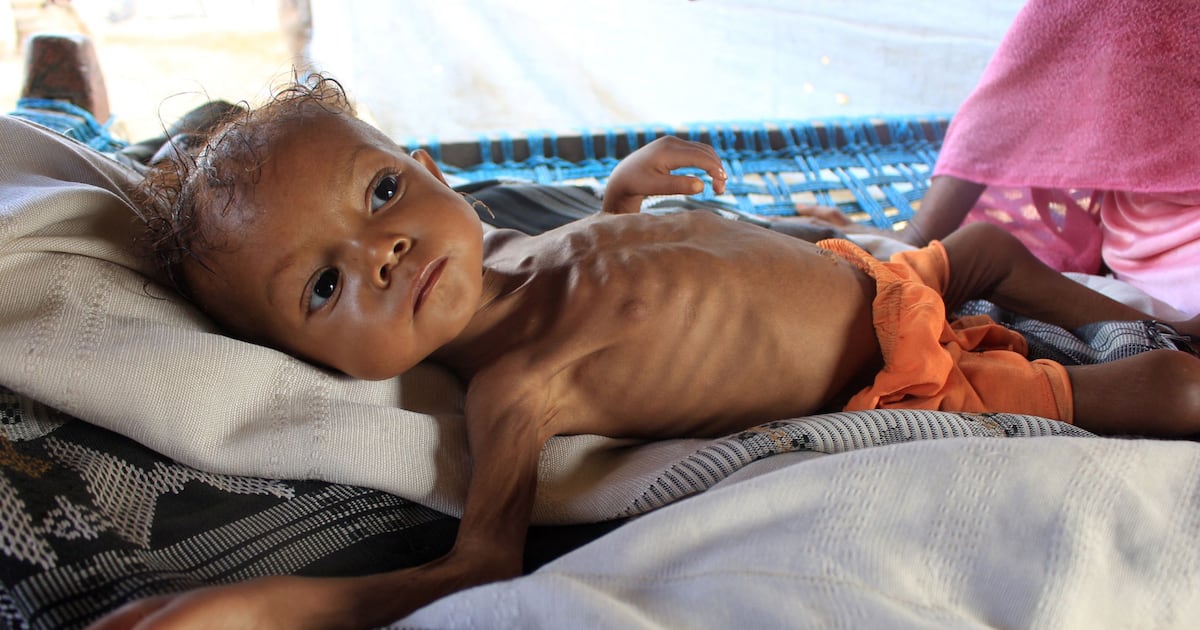 Thread Hunger War means hunger, warns UN chief | The National