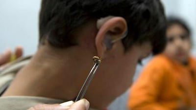 Because conventional drugs are often too expensive, Gazans seek out alternative remedies such as bee stings.