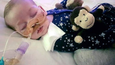 Charlie Gard suffers from a rare genetic condition that has left him with brain damage and unable to breathe unaided