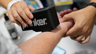 Prinker's digital device can print temporary tattoos. AP