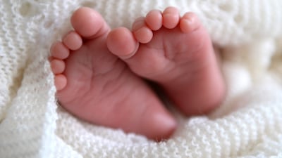 A study by the NHS Race and Health Observatory has said some newborn tests do not cater for all babies. PA