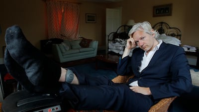 WikiLeaks founder Julian Assange is seen with his ankle security tag in 2011. AP