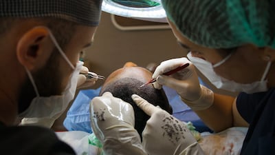 There are two types of hair transplant treatments, with costs typically starting at Dh10,000 in the UAE. Getty Images