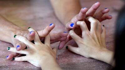 Silvia Santos da Silva and Maria Santos, who were both born with twelve fingers, join hands in their home in Brasilia, on June 21, 2014. The family was born with an extra digit on each hand as a result of a genetic condition known as polydactyly, and hoping to celebrate Brazil’s sixth world title in the 2014 World Cup. AFP