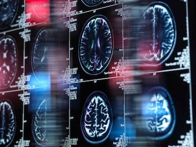 Mr Vohra's study focused on chest X-rays, brain MRI scans and dermatology images. Photo: Getty