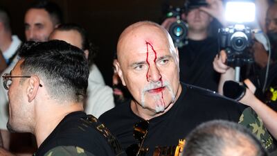 Blood pours down the face of John Fury following an altercation with a member of Oleksandr Usyk's team. PA