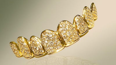 The world’s most expensive smile; diamond-encrusted gold dentures prices at Dh562,000. Courtesy Liberty Dental Clinic