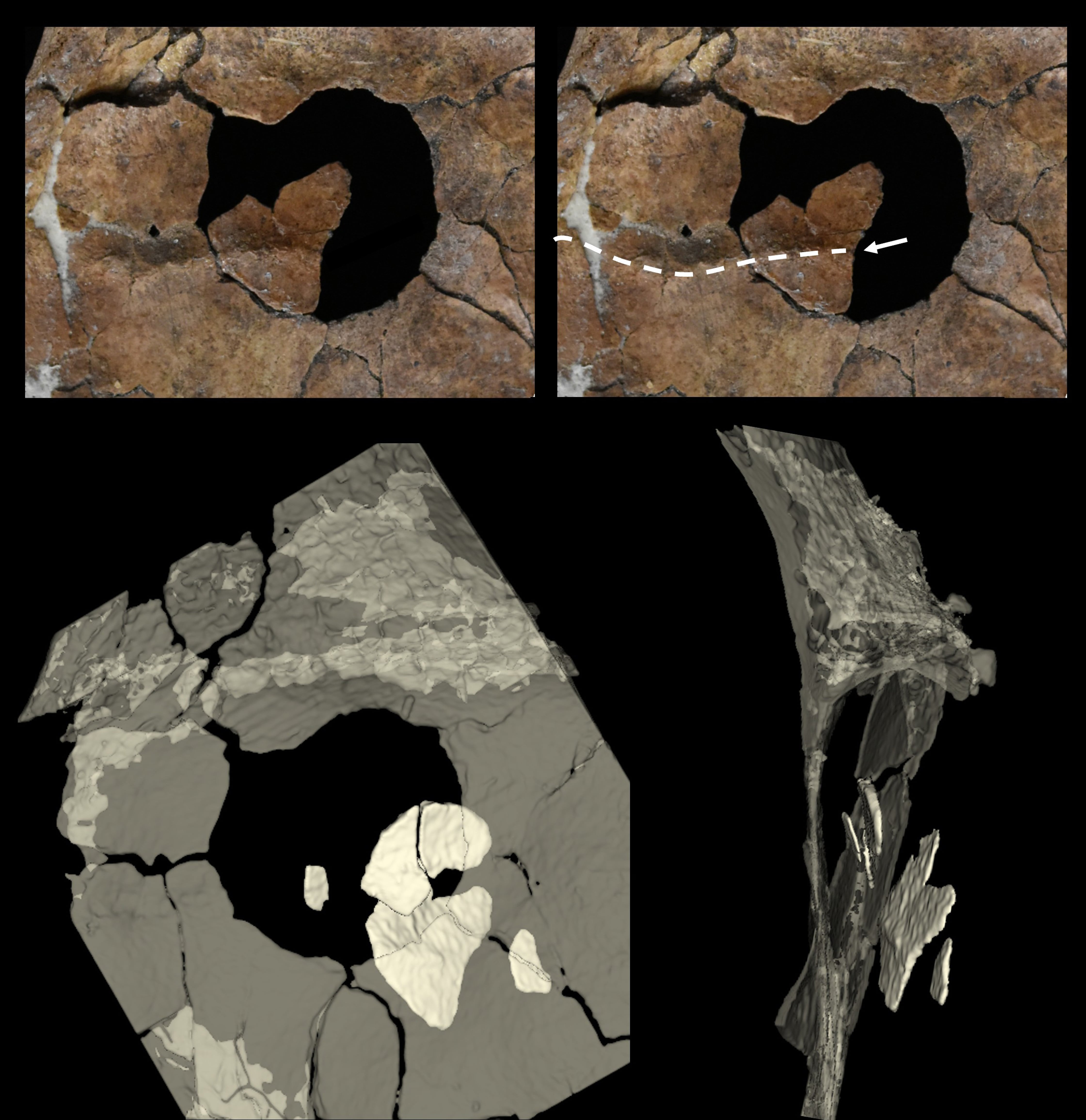 The hole in the scapula and the bone fragments found embedded in the sediment. Photo: Dr Emma Pomeroy