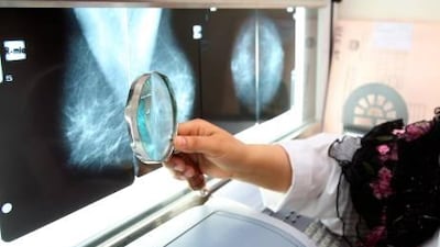 Breast cancer accounts for nearly 23 per cent of all cancer cases in the UAE.
