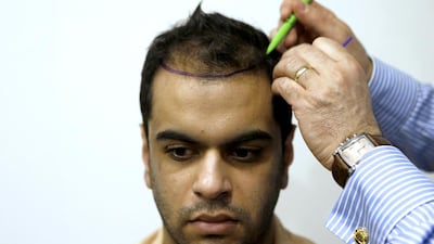 Various forms of hair transplants are the second most common surgery. Costs vary from about $4,000 to $15,000, depending on the procedure. Murad Sezer / Reuters