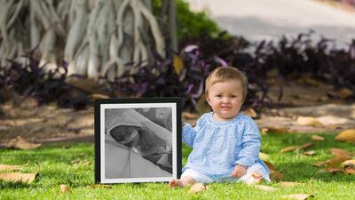 Penelope Foulkes was born premature and her mother participates in the UAE support group Small and Mighty. Photo courtesy Alex Jeffries