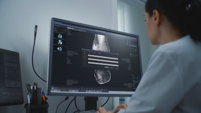 The UAE has approved a breast cancer drug which its manufacturers say can reduce the deadliness of the disease by 56 per cent. Getty Images