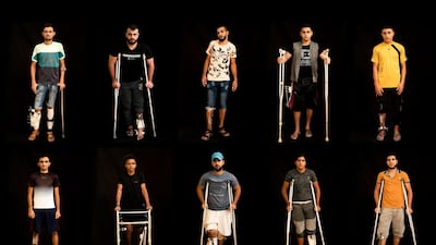 Palestinians shot in the legs during demonstrations at the Gaza strip's border with Israel pose as they await treatment at a Gaza City clinic run by MSF (Doctors Without Borders). Israeli forces deployed along the volatile border have fired live rounds at rock-throwing Palestinian protesters since demonstrations began in March against Israel's long-running blockade of Gaza. Israeli snipers have targeted one part of the body more than any other: the legs. AP