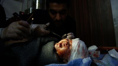 A Syrian child who was injured in shelling on the town of Misraba receives treatment at a make-shift hospital. Hamish de Bretton-Gordon is calling on the UK government to do more to help those caught in the warzone. AFP PHOTO / HASAN MOHAMED