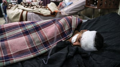 A injured boy is treated at a hospital in Douma after Syrian government bombing of the Eastern Ghouta region that killed at least 36 people on February 7, 2018. Mohammed Badra / EPA