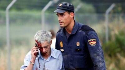 An injured man, identified by Spanish newspapers as the train driver Francisco Jose Garzon, is helped by a policeman after a train crashed near Santiago de Compostela, northwestern Spain.