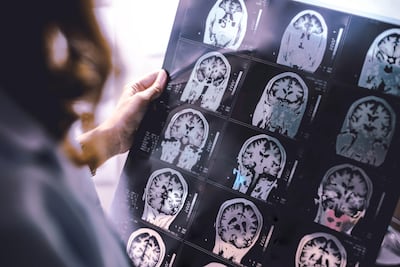Dementia risk factors middle age. Adobe