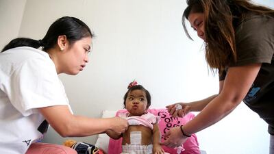 Aleeyah had biliary atresia diagnosed after she became jaundiced at the age of two months.