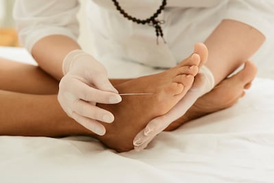 Acupuncture points in the feet can be accessed to help with insomnia or anxiety, experts say. AFP