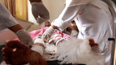 A Yemeni men, wounded in the mosque attacks in Sanaa the day before, receives treatment at a hospital in the capital on March 21, 2015. Mohammed Huwais/AFP Photo