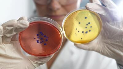 Researchers say doctors may have relied too heavily on antibiotics. Getty