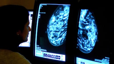 The number of cases in the UAE is rising due to a growing population, but also due to obesity and smoking rates. Rui Vieira / PA Wire