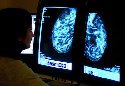 A consultant analyses a mammogram to check for breast cancer. PA