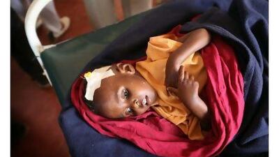 A refugee child lies in a hospital ward in the Ifo refugee camp, a part of the giant Dadaab refugee settlement in Kenya, close to the border with Somalia. Oli Scarff / Getty Images