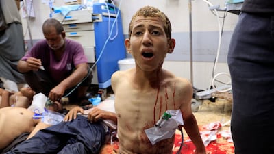 Palestinians wounded while seeking aid in Gaza are treated at Nasser Hospital, in Khan Younis. Reuters