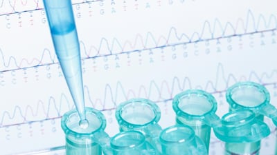 Researchers used a process known as Whole Genome Sequencing. Getty Images / Cultura RF