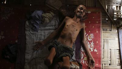 Muhammad Ali, a 54-year-old Rohingya man suffering from tuberculosis for over a year, lies inside his room at the Thet Kae Pyin camp for internally displaced people in Sittwe.