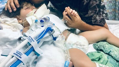 Abdullah Hassan, a 2 year old from Yemen who is on life support in California.